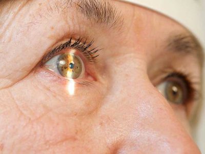 Common Eye Diseases and Surgeries