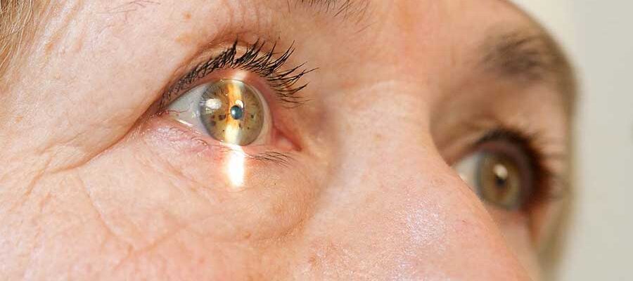 Common Eye Diseases and Surgeries