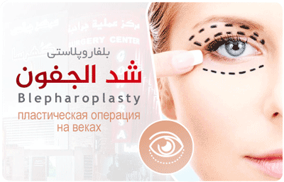 Blepharoplasty cosmetic surgery in Goharsa Surgical Center