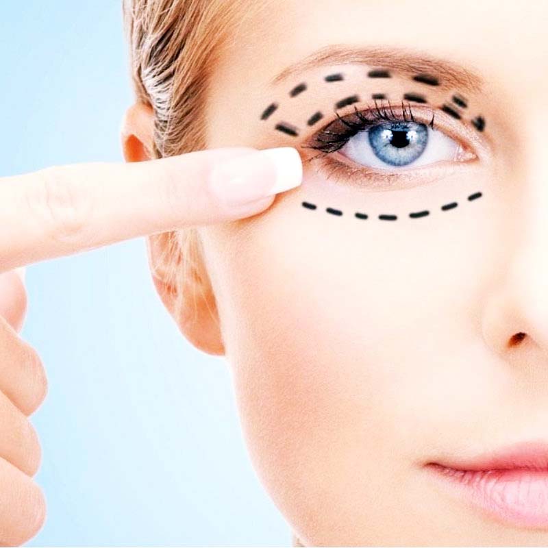 Eyelid and eye cosmetic surgery or blepharoplasty